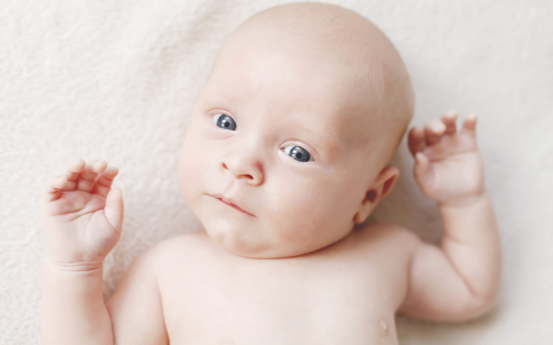 Torticollis, a head turning preference or plagiocephaly